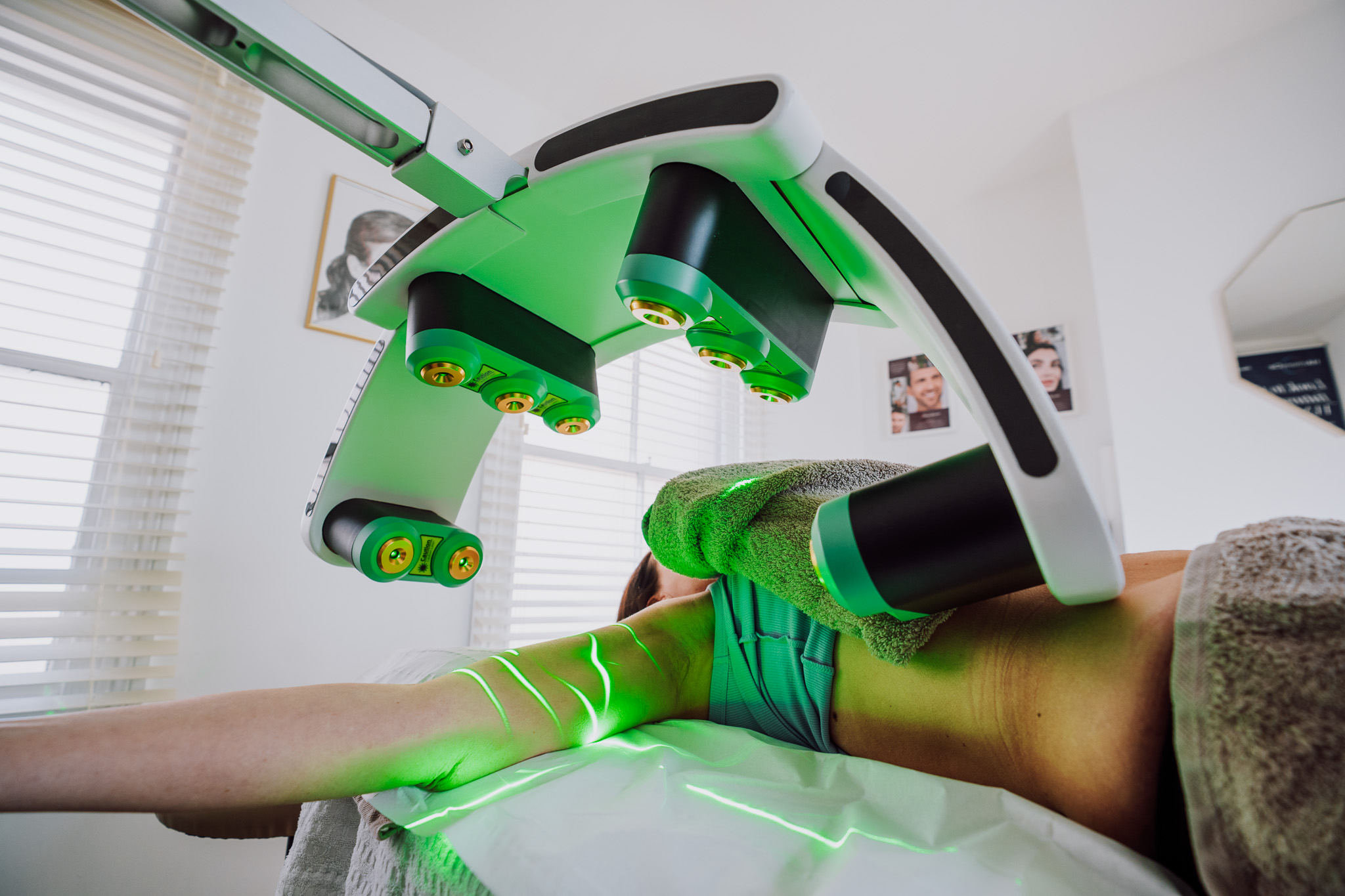 body contouring treatments leicester