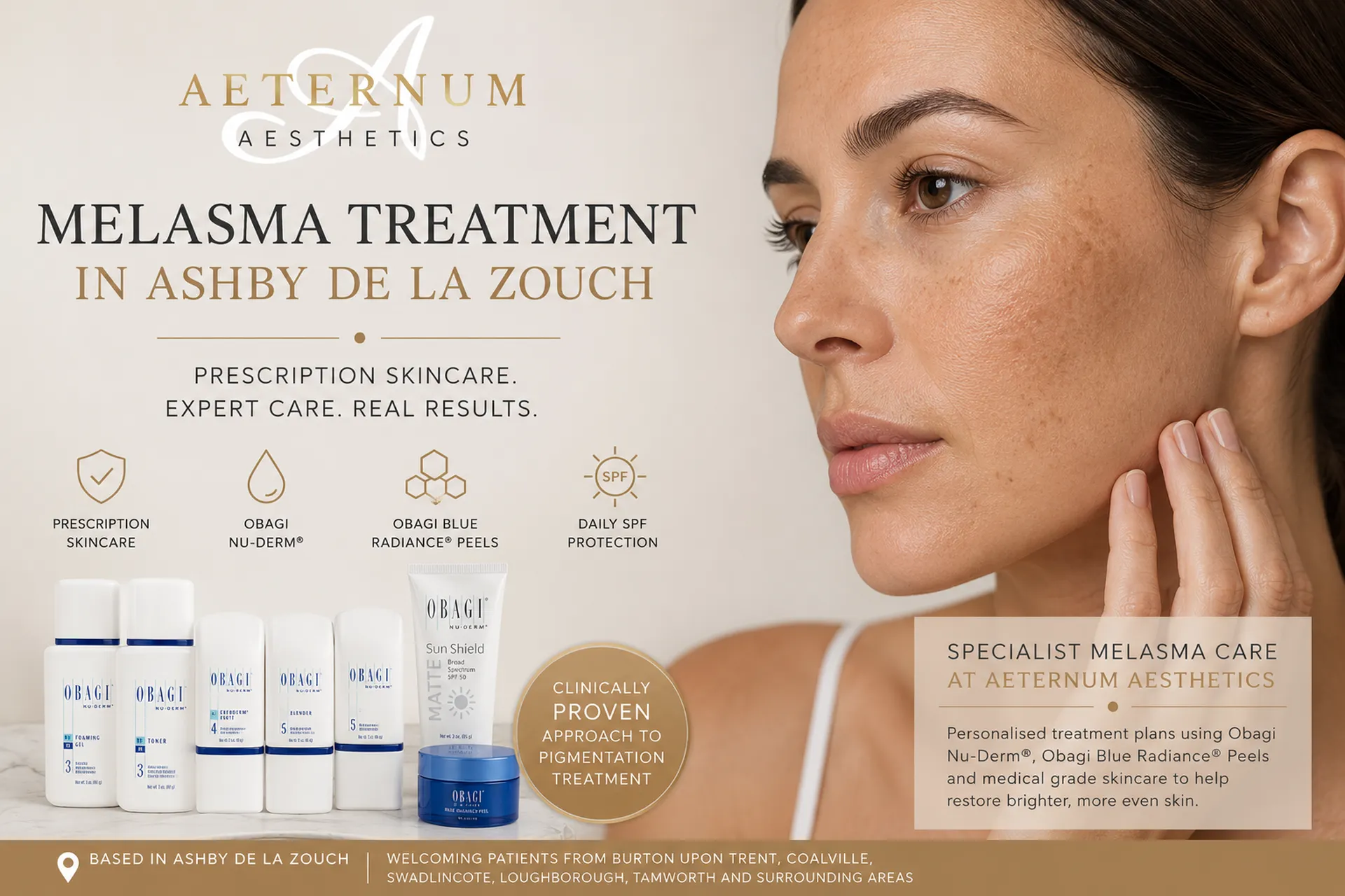 Melasma Treatment in Ashby de la Zouch